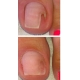 GEHWOL Nail Repair Gel (H) - Clear 5ml