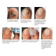 Kapolin / Gehwol Nail edge tamponade thin 14mm x 10m 1 roll